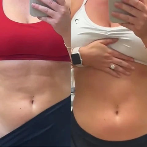 Smooth skin. In weeks. Guaranteed.